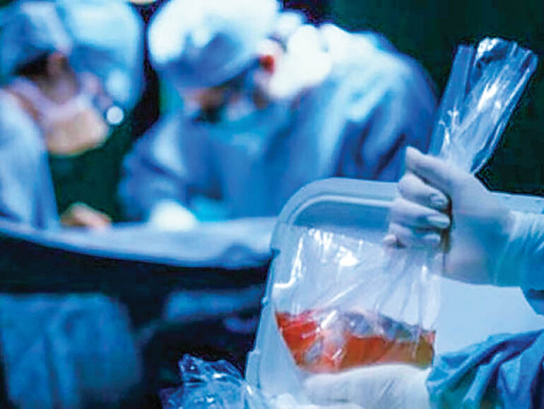 Oman’s organ donation law to combat illegal trade, reward donors